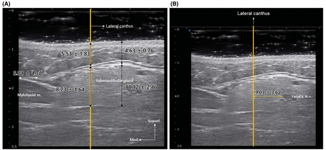 韩国的“瘦脸针”打法，越来越“逆天”