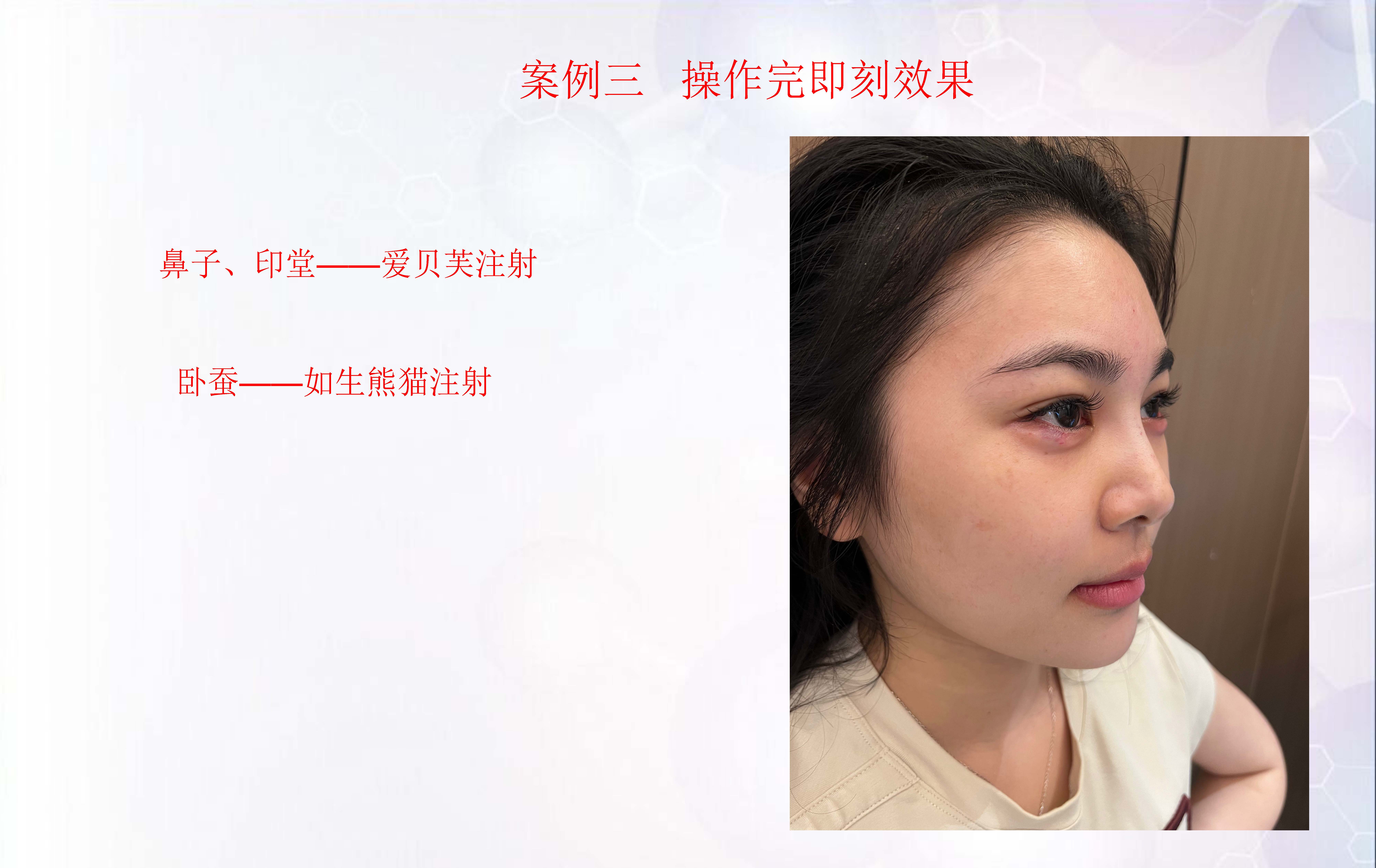 贺五洲医师培训课件