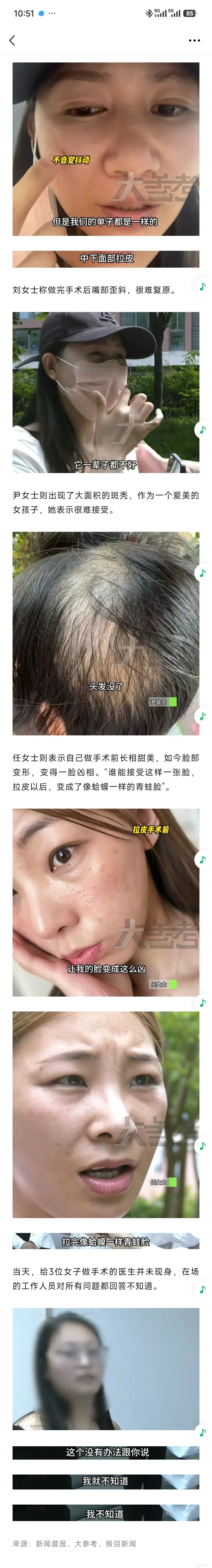 嘴歪、脸抖、斑秃：3人集体“毁容”的背后，藏着医美圈最致命的骗局