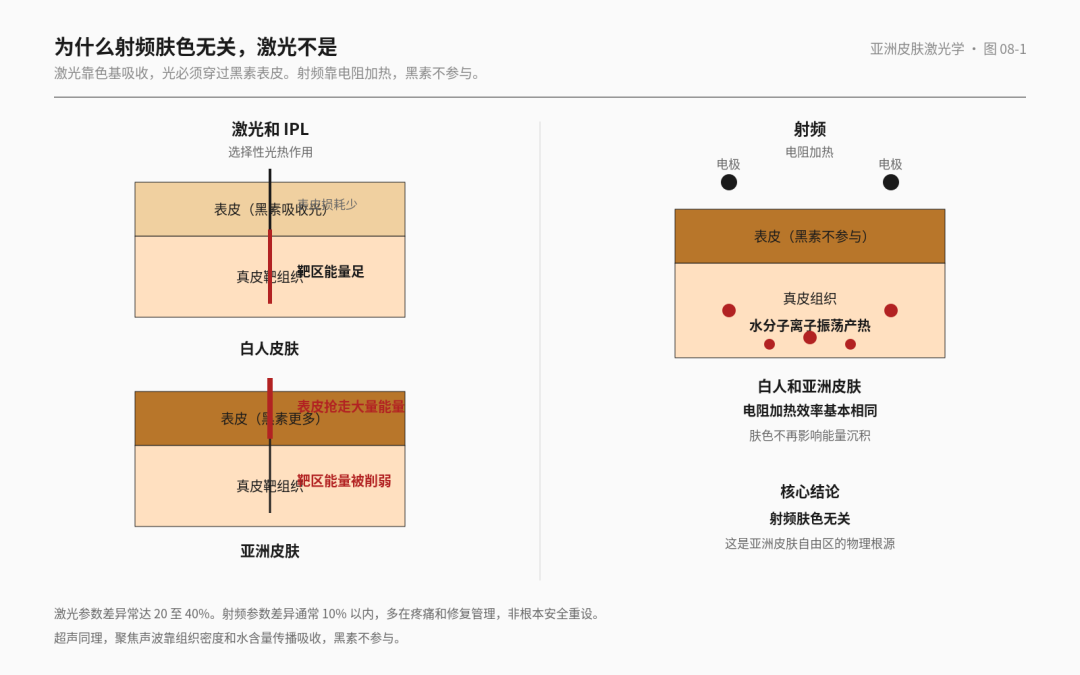 激光二十讲 07 · 射频超声微针，不是激光但绕不开