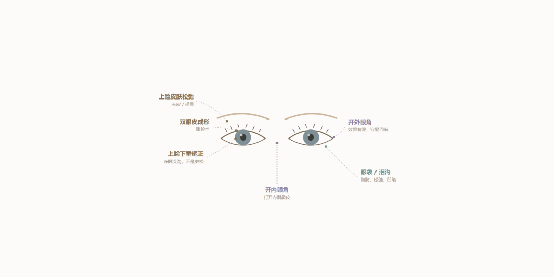 眼整形到底在整什么