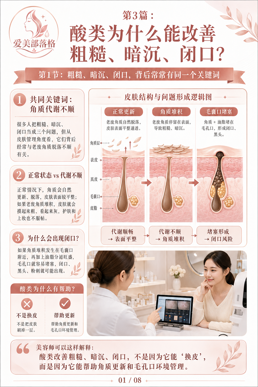 第3篇：酸类为什么能改善粗糙、暗沉、闭口？